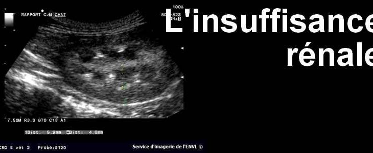 Insuffisance rénale : « j’ai décidé d’arrêter la dialyse, je n’en pouvais plus »