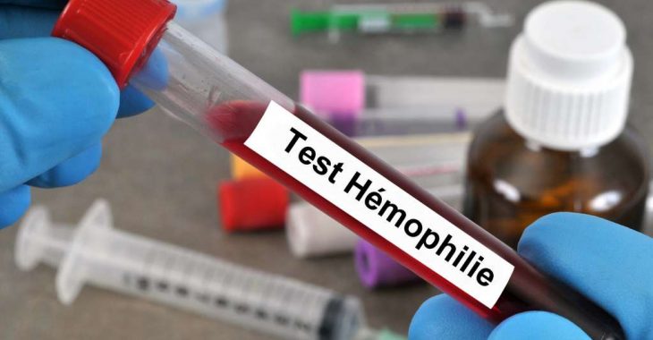 « A cause de l'hémophilie, quand je me blesse, le sans ne cesse pas de couler»
