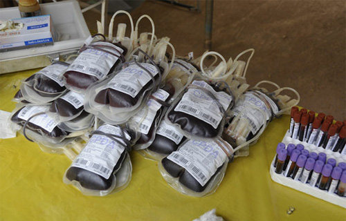 Burkina : pénurie de sang en période des pluies